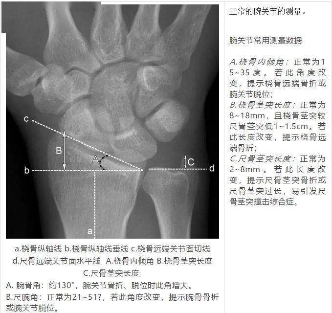 影像解剖丨腕关节大全