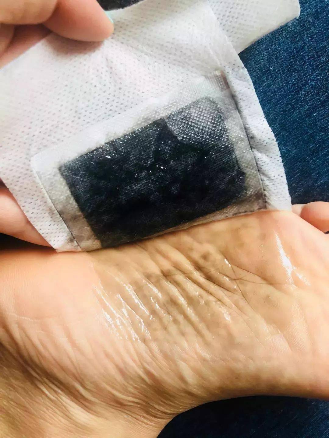 一贴胜过10碗薏仁汤这款泰国足贴界的lv让你躺着祛湿气