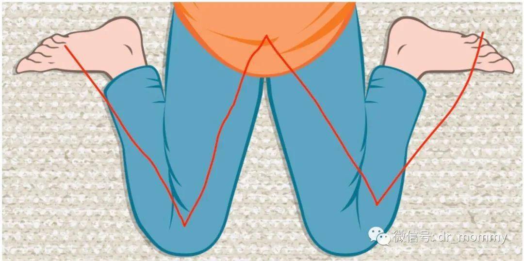 一站式父母课堂,  纯原创@drmommy  w 型坐姿(如题图),一直是妈妈们挥