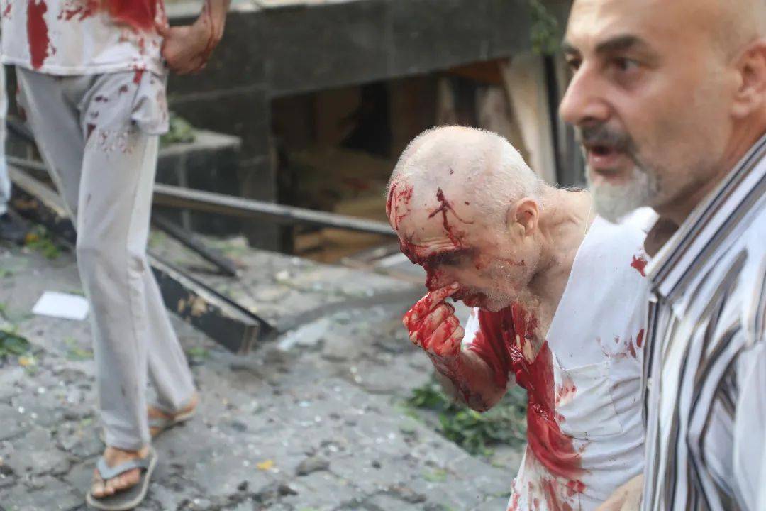 医院挤满了伤员贝鲁特爆炸已造成上百人死亡30万人流离