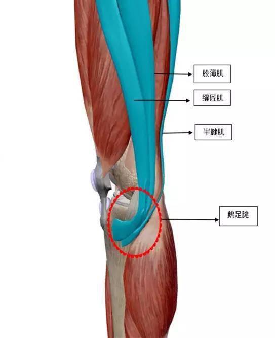 鹅足腱鹅足腱是缝匠肌,股薄肌,半腱肌三块肌肉之腱性部分在胫骨近段