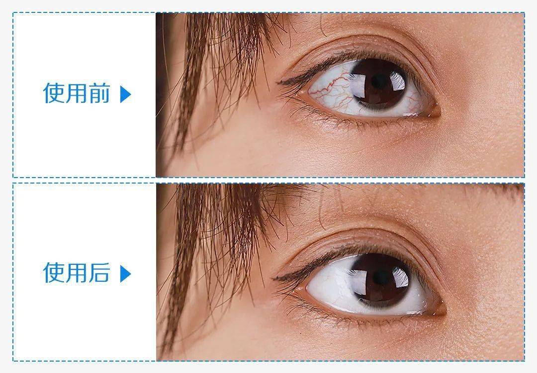 到底要不要用洗眼液多人试用效果惊掉下巴这么脏是认真的吗