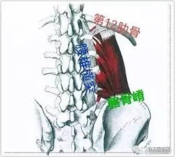 腰骶棘肌肌纖維作用於脊椎,如果是單側用力,將導致腰椎伸屈和側彎