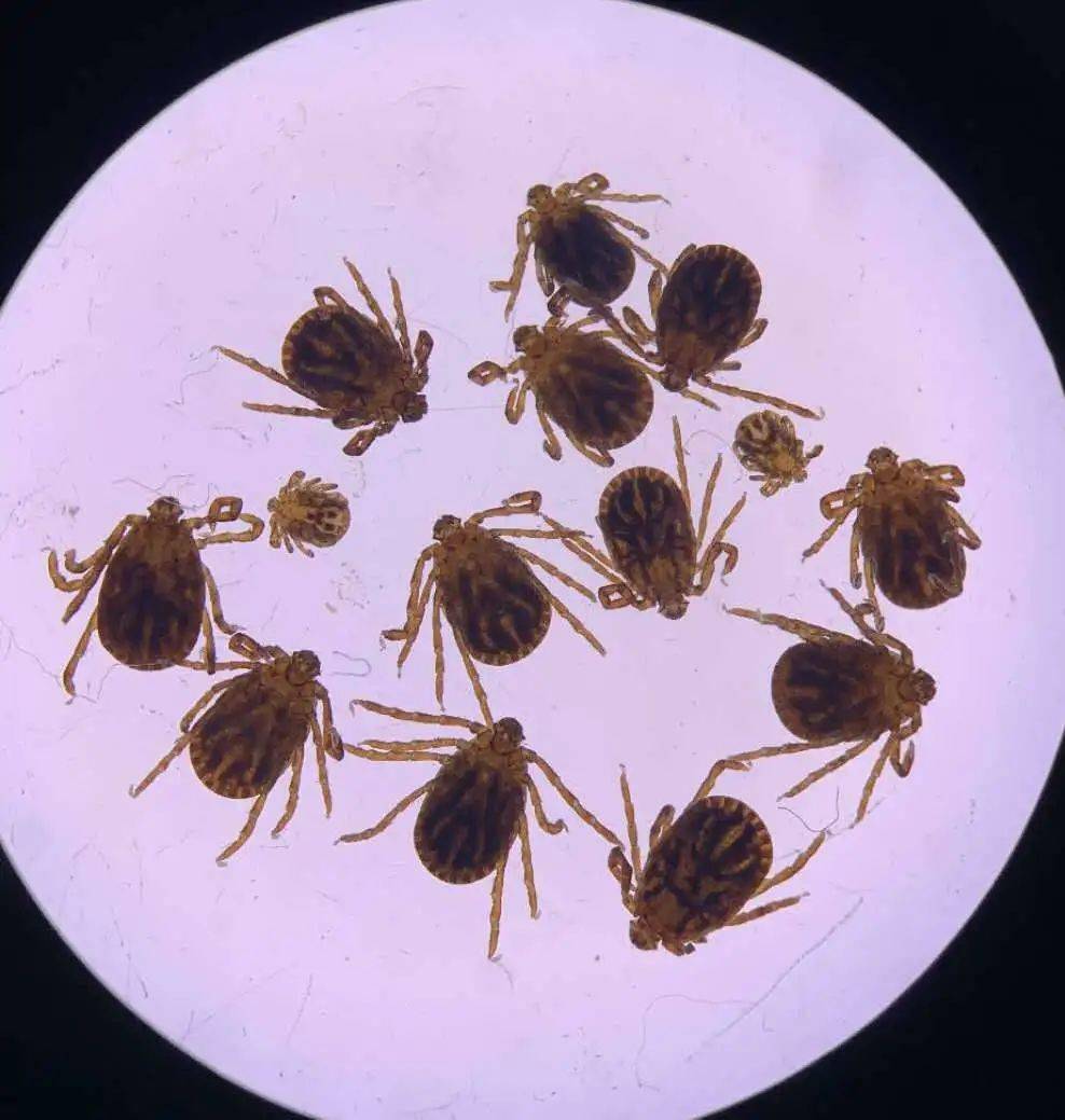 热点转发八旬老翁阴囊处发现蜱虫附着提醒谨防蜱虫叮咬