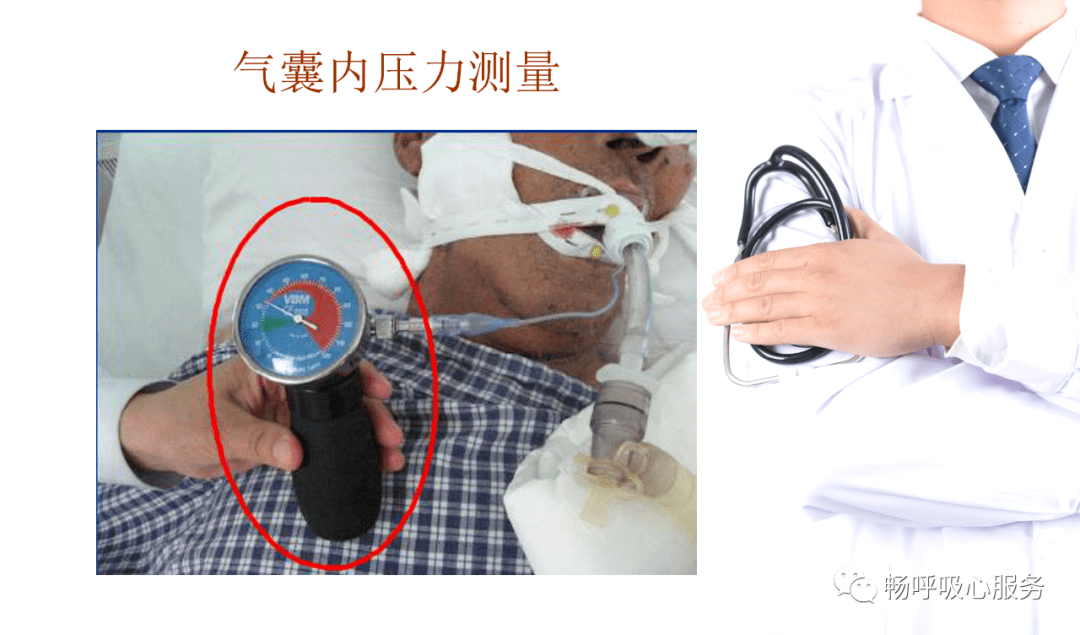 来源:畅呼吸心服务返回搜狐,查看更多