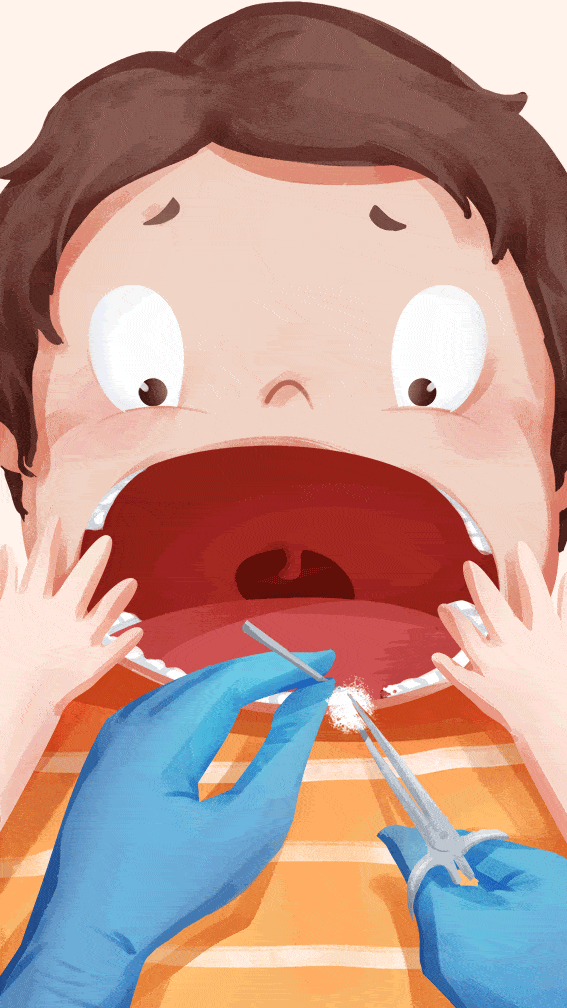 饭后要用清水漱口,或者嚼两粒无糖口香