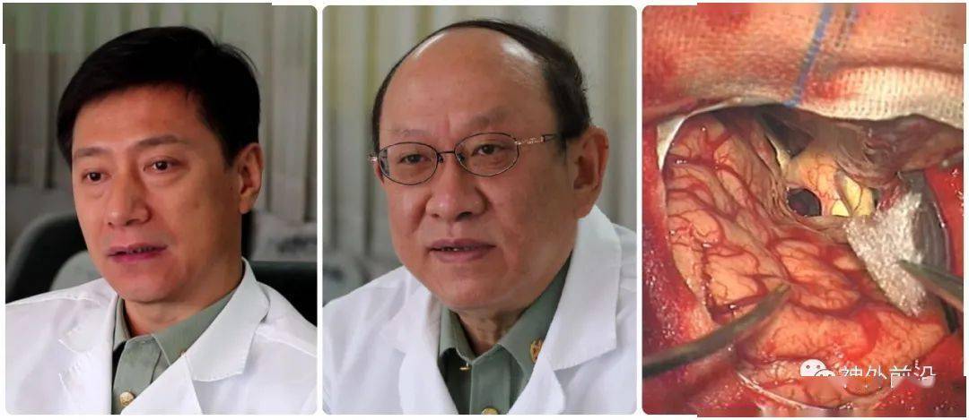 佳品有约| 说透颅咽管瘤各手术入路 哪些做法不可取 - 姜金利 许百男