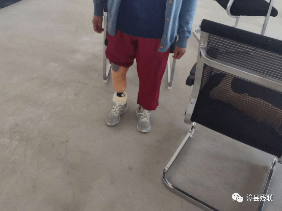 漳县残联残疾人假肢安装活动