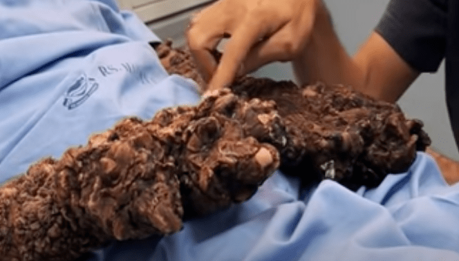 医生每年从他们身上切下 10 斤「树枝」:一半是人,一半是树的怪病患者