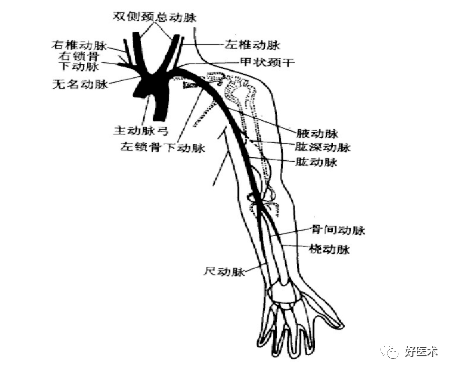 头臂干 解剖图图片