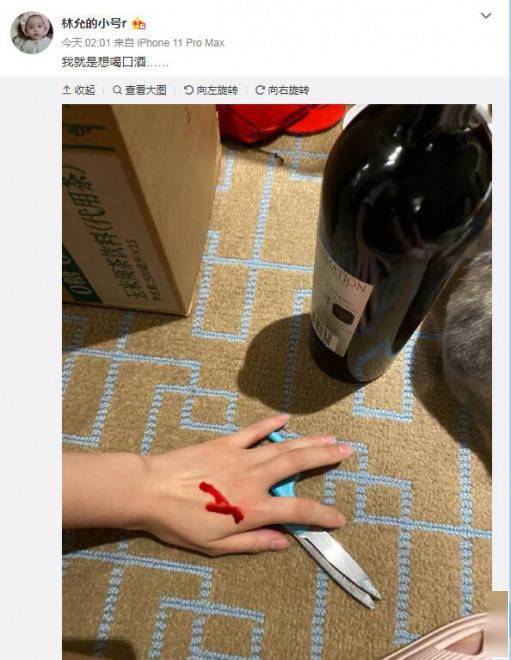 林允受伤出血小号连发照片 网友:拍照比止血重要