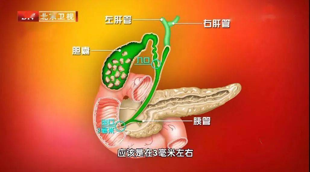 身体里的钙跑错了地方可能让血管变硬肝胆结石关节疼