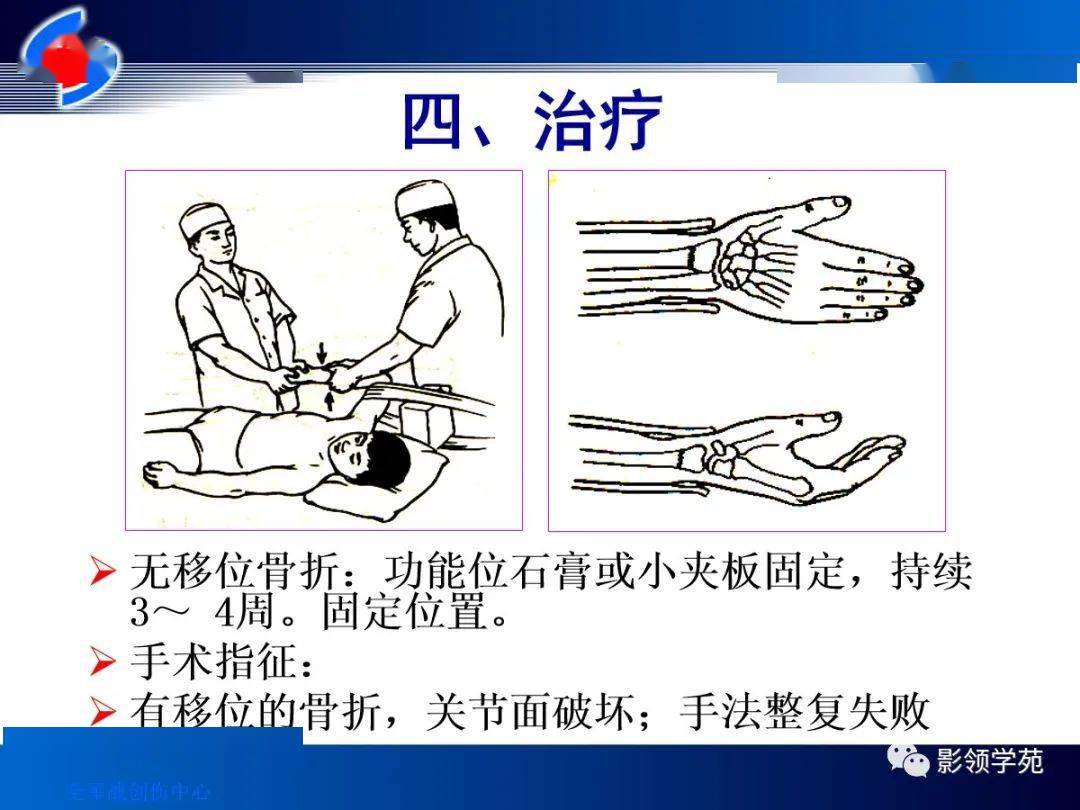 10种上肢骨折的影像学表现