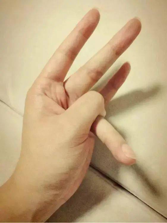 经常把手指掰得"咔咔"响,但是你的手指可能会变这样