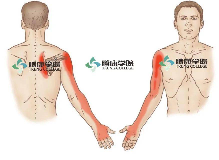 的手臂内旋,且睡躺在患侧会造成不适;容易在肩膀前侧产生强烈的深层痛