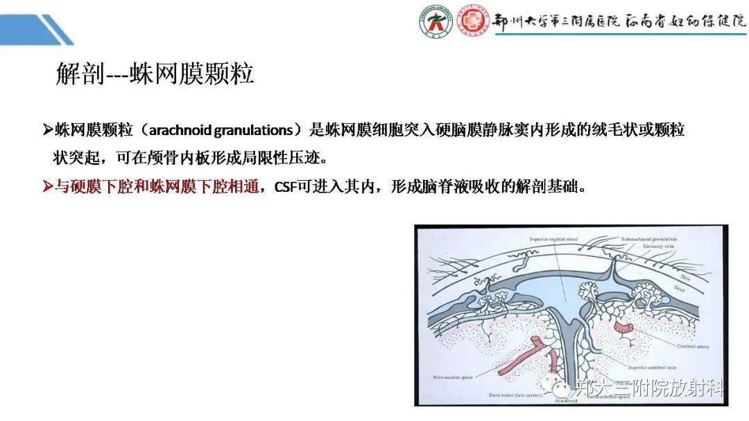 蛛网膜颗粒图片