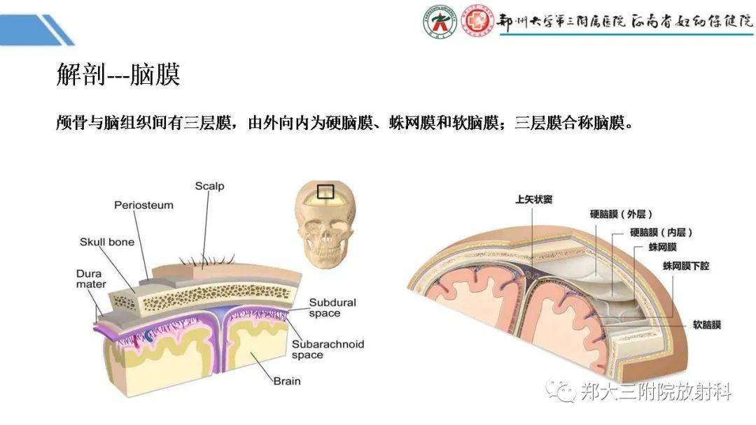 蛛网膜颗粒可不要认错了