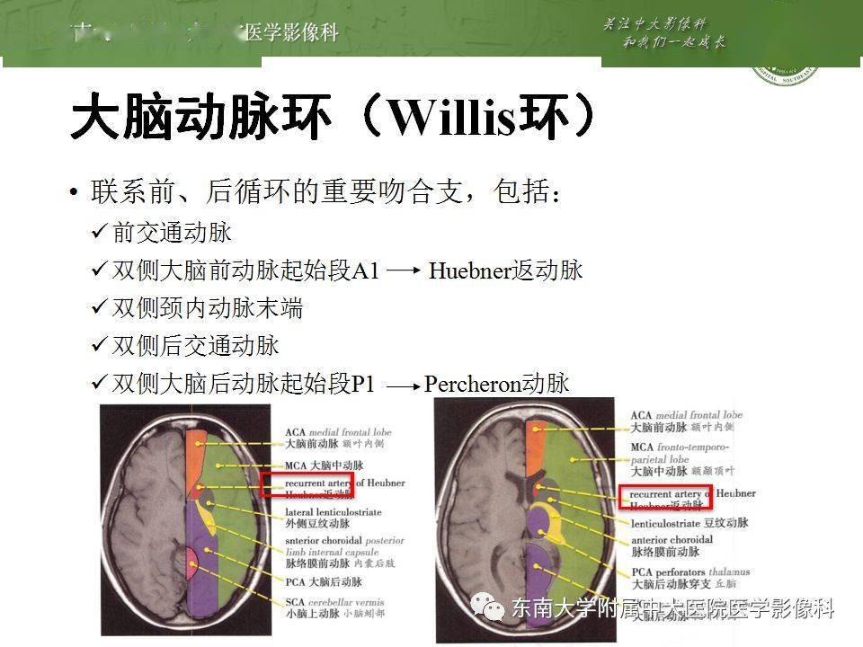 解剖頭部血管解剖及willis環常見變異