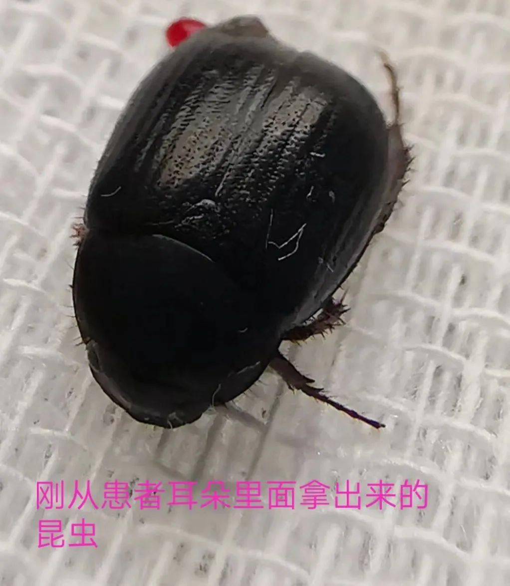 黑色扁平的虫子图片