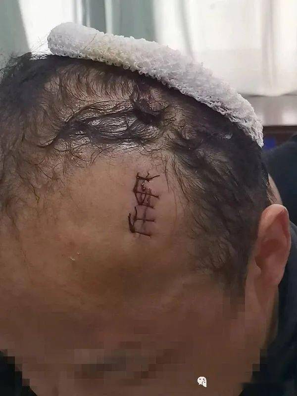 永年男子当街被爆头【附视频】.