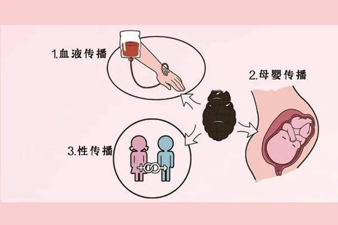 【妇幼科普】艾滋病,梅毒,乙肝母婴阻断传播_艾滋病毒