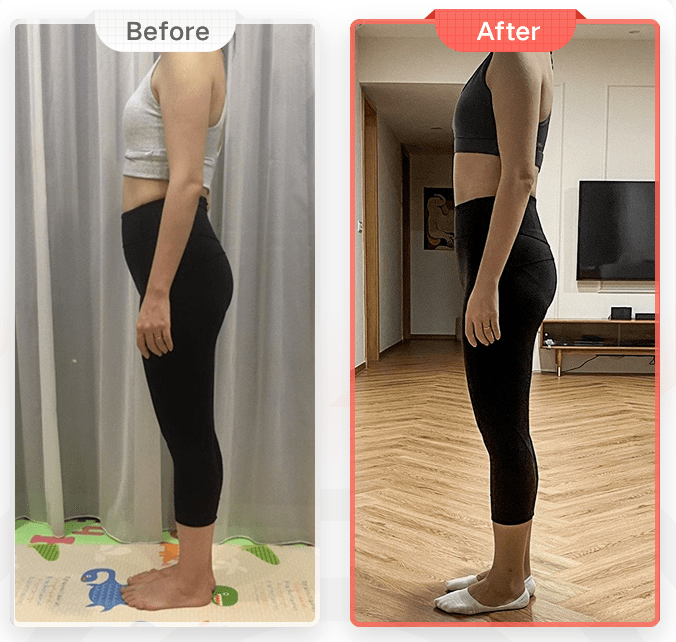 纠正骨盆前倾身材就会变好吗