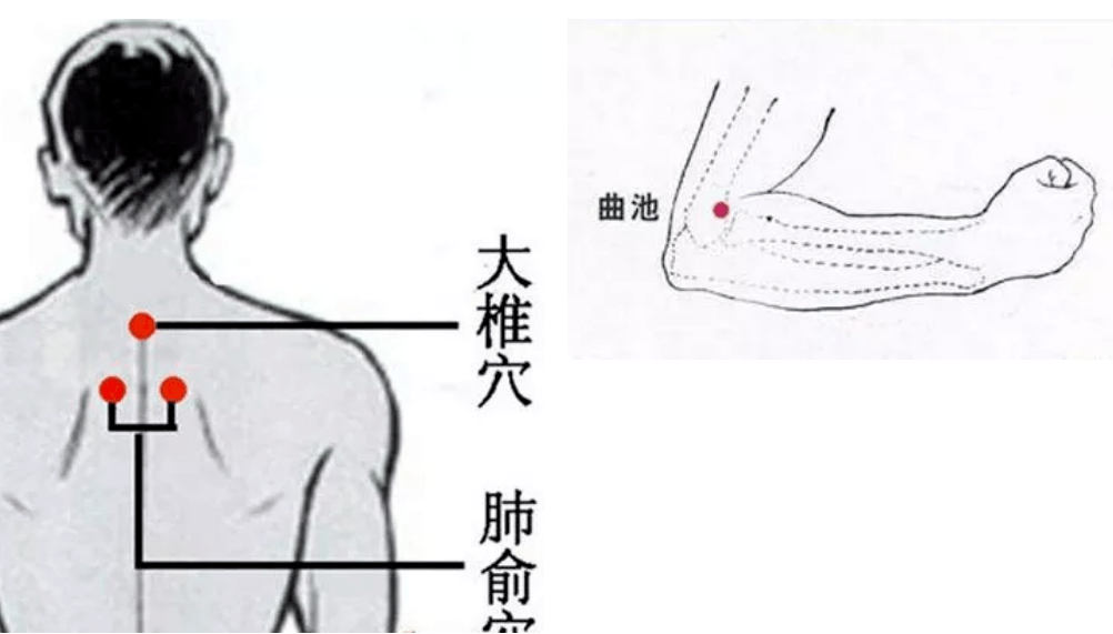 肺門淋巴結核主穴:身柱,肺俞(或只灸身柱)配穴:中脘,足三里.