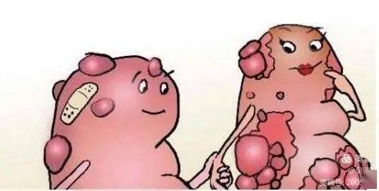 查出结节息肉囊肿增生该怎么办健康管理专家为您解读