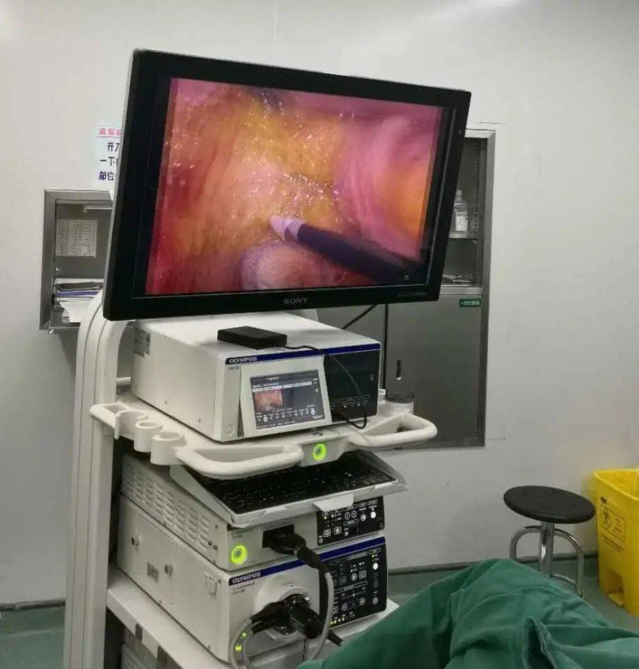 辽东地区首台4k,3d腹腔镜落户我院_手机搜狐网