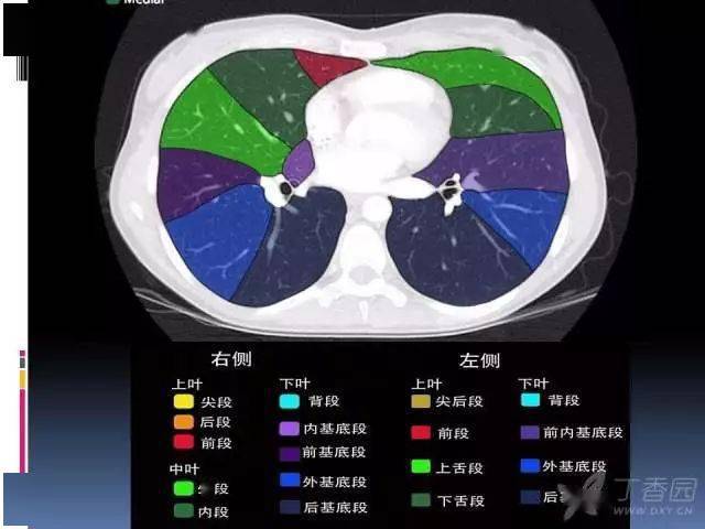 肺ct分叶分段解剖图图片