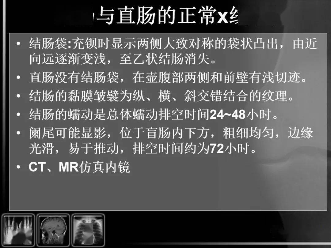 消化道疾病影像诊断与鉴别