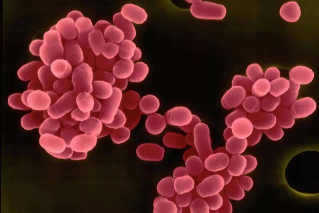 布鲁氏菌病你需要了解这些知识点