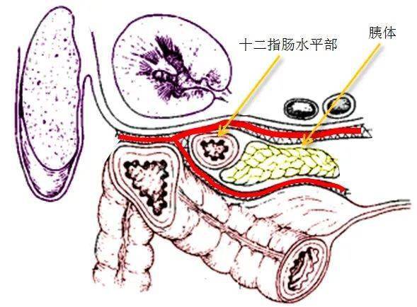 医学笔记|左半结肠切除术中避免胰腺损伤的要点