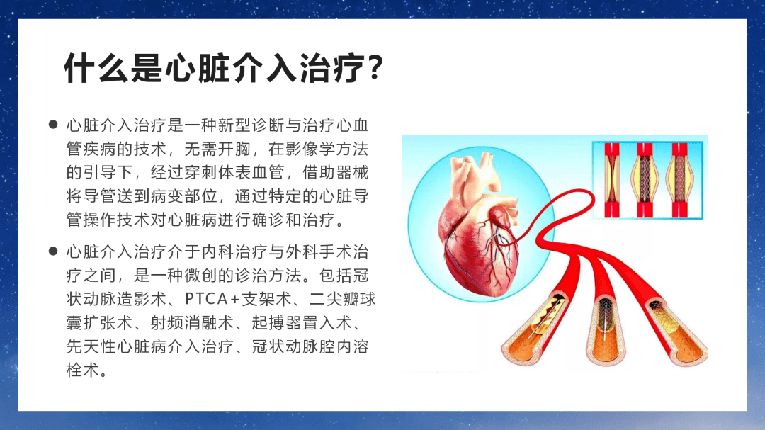 介入治疗健康宣教图片图片