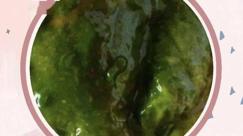 宝宝胃肠道感染,大便也会呈绿色(淡绿色/亮绿色),大便稀薄水样,粘液多