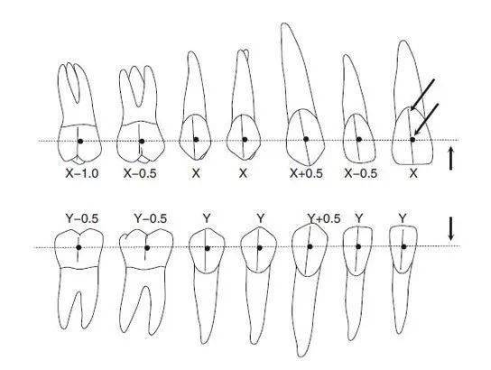 67orthguide03奥世美03托槽如何进行定位