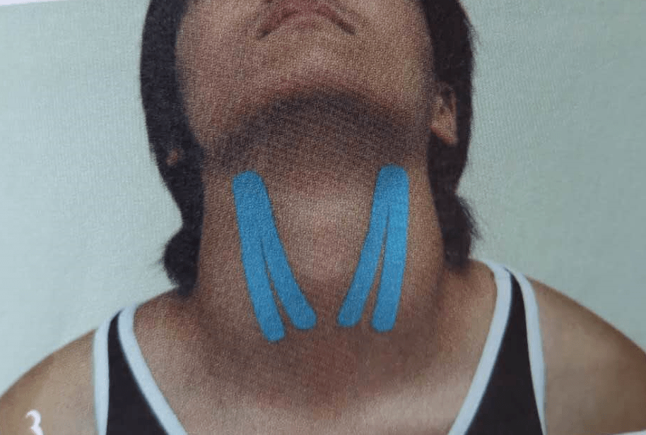 lp图解肌贴鼻塞喉咙痛