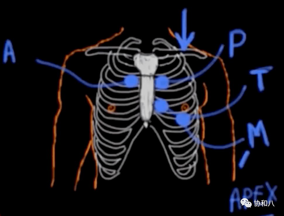 听诊区基础知识注意:本视频只讨论左心杂音如果你没有时间点开视频