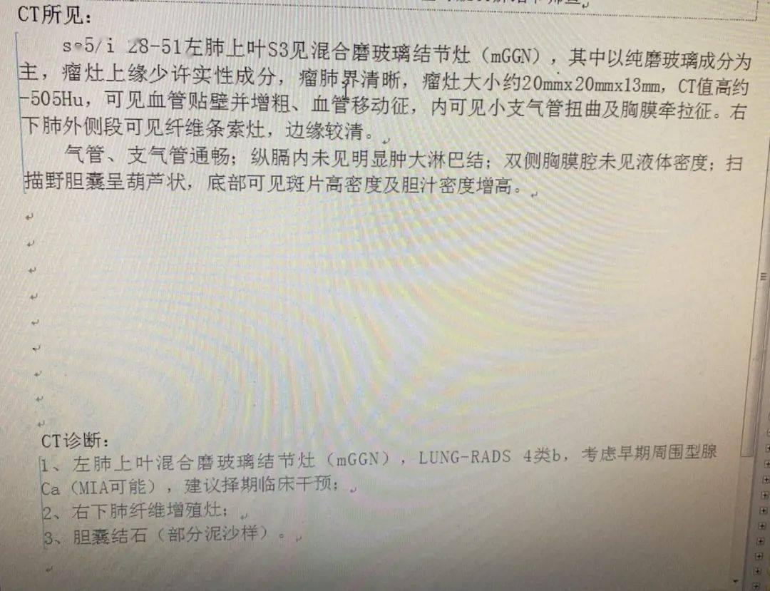 淄博市第四人民醫院低劑量螺旋ct人工智能診斷ai助力精準肺癌篩查