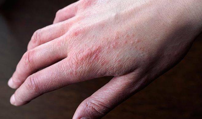 一夜之间!澳洲公寓楼长出巨型吸金蘑菇!