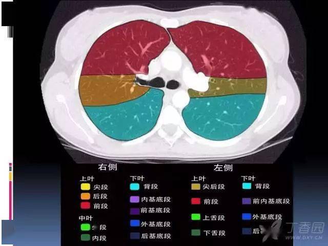 左肺上叶舌段CT图片