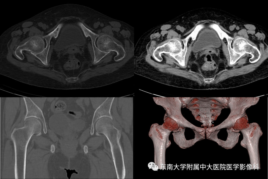 mri编辑/校对:时文伟返回搜狐,查看更多