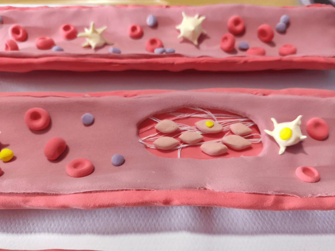 红细胞模型制作橡皮泥图片