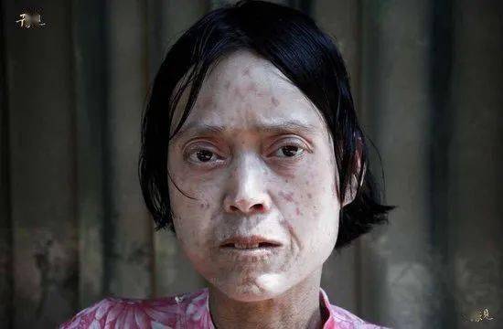 不止是她.全村2400多人,80%的青壮年常年患肠炎.