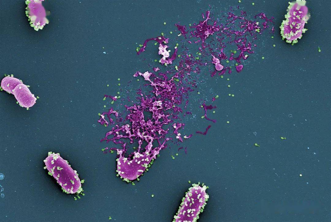 细菌的天敌噬菌体