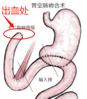 输入袢与输出袢图片