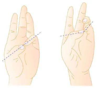 (二十九)30拇指对掌试验(palm to palm test of thumb)正常拇指对掌