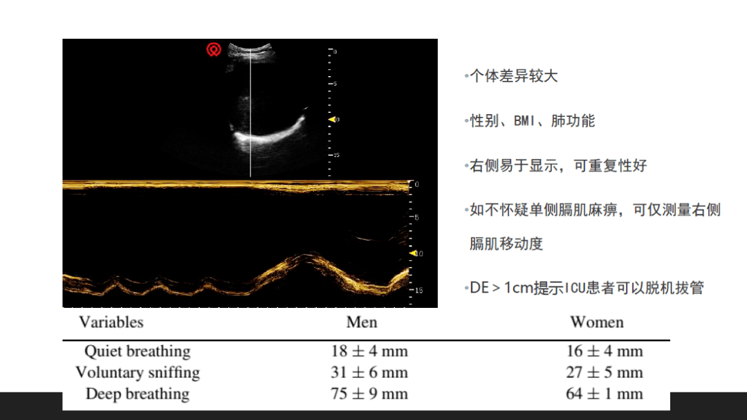 临床指南与知识更新膈肌超声的应用