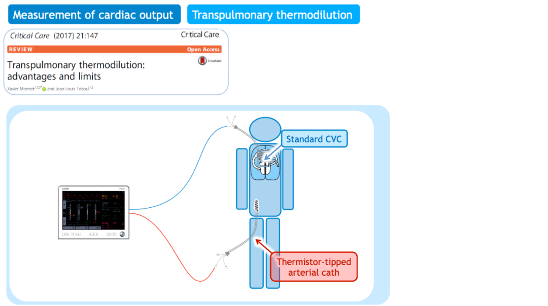 picco在icu中的应用