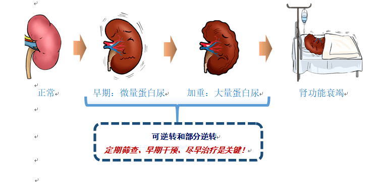 糖友课堂糖尿病慢性并发症之糖尿病肾病